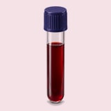 Blood sample