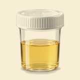Urine sample